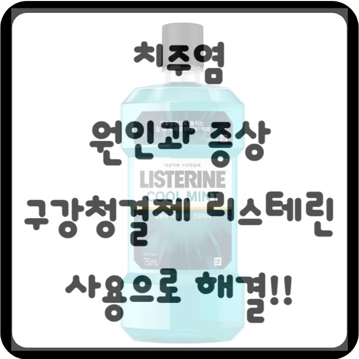 치주염 리스테린