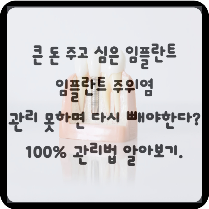 임플란트 주위염 100% 관리법 알아보기