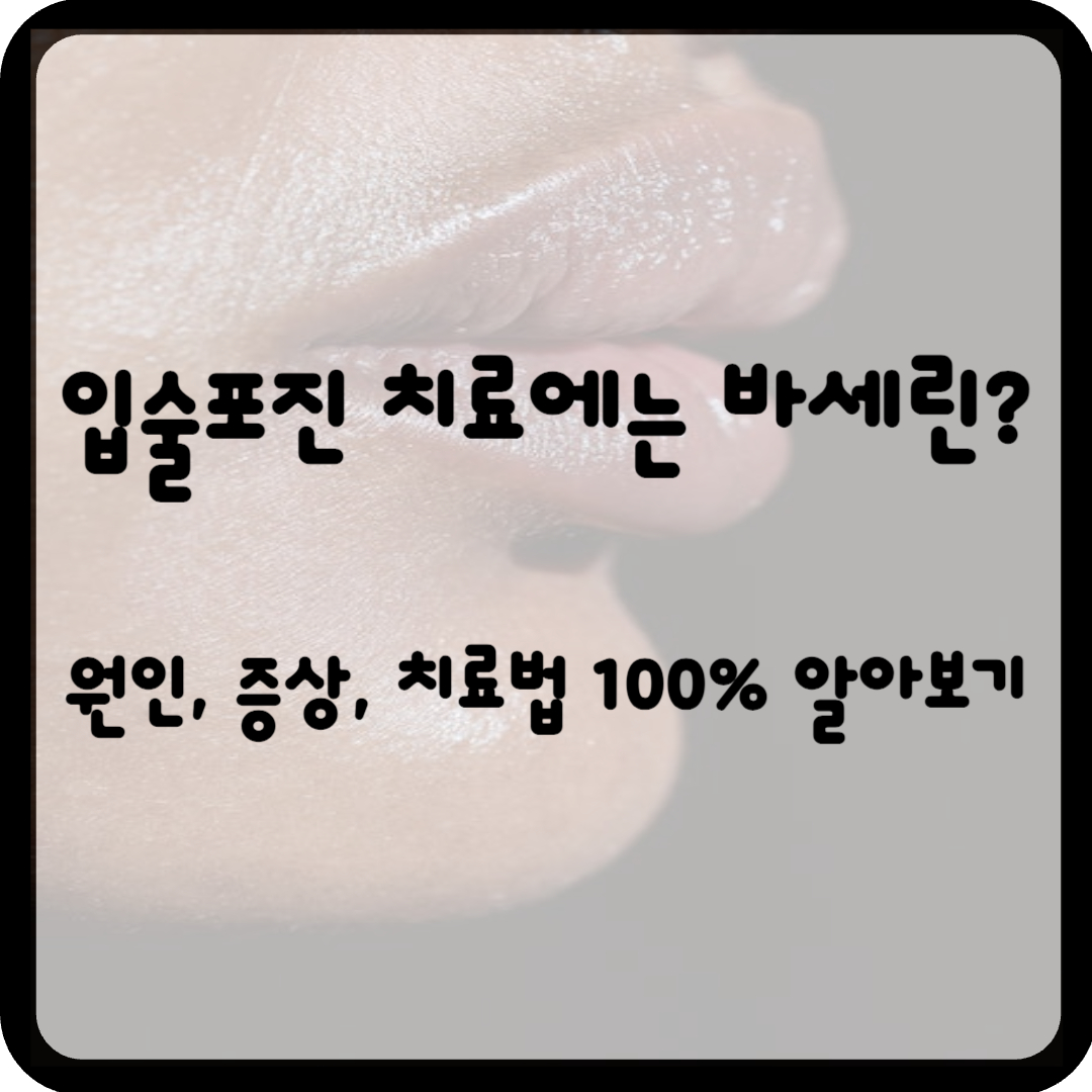 입술포진 바세린? 입술포진 원인, 증상, 치료법