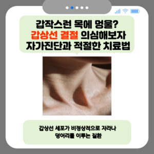 갑작스런 목에 멍울? 갑상선 결절 의심해보자