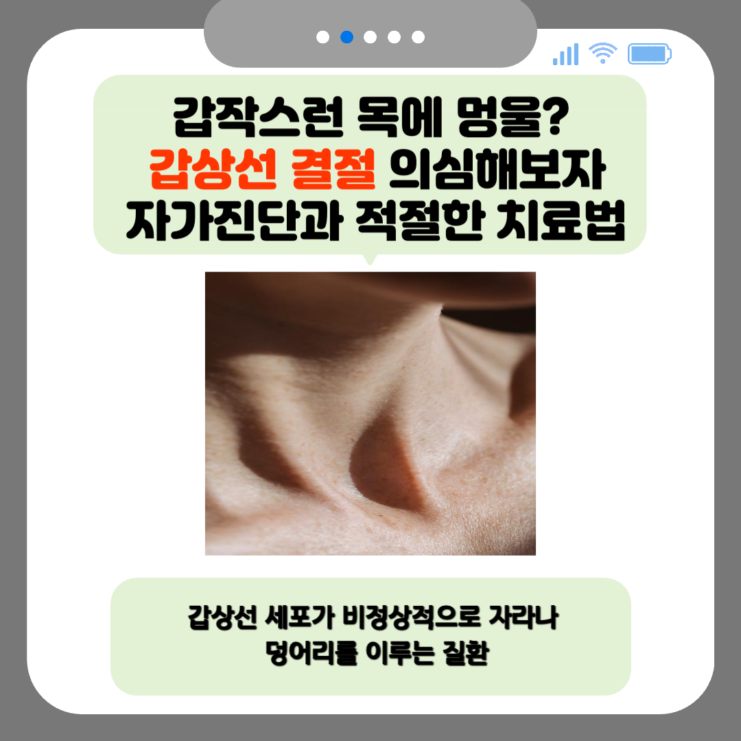 갑작스런 목에 멍울? 갑상선 결절 의심해보자