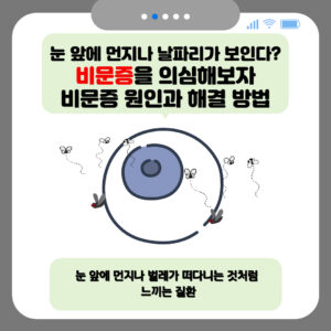 눈 앞에 먼지나 날파리가 보인다? 비문증 의심해보자